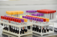 В Италии выявили на 3 тысячи новых случаев коронавируса меньше, чем днем ранее