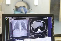 Ученые описали, как коронавирус атакует легкие сразу после заражения