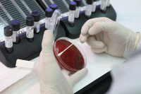 В капиллярах мозга жертв коронавируса нашли микротромбы