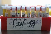 Победить COVID-19 в этом году вряд ли удастся, считают в ВОЗ
