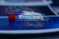 В Италии коэффициент распространения COVID-19 снизился до 0,85