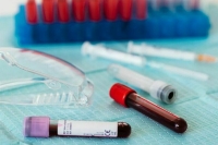 Первый случай зараже­ния &laquo;омикрон&raquo;-штаммом зарегистрирован в Се­рбии