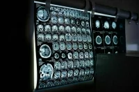 Регистрацию отечественных медизделий предлагают ускорить