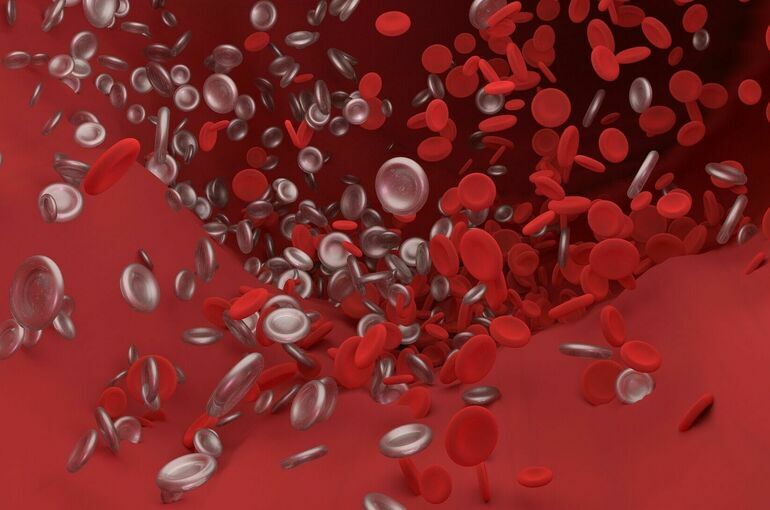 Врач рассказал о риске возникновения тромбоза после COVID-19