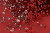 Врач рассказал о риске возникновения тромбоза после COVID-19