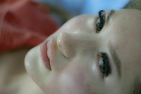 Врач предупредила об опасных последствиях купероза на лице