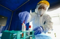 В США зафиксирована самая высокая в мире заболеваемость обезьяньей оспой