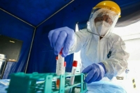 В Калифорнии ввели режим ЧС из-за вспышки оспы обезьян