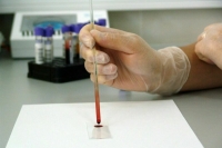 Врач рассказал, что поможет выявить гепатит C на ранней стадии