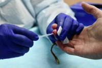 Эксперт рассказал, где можно бесплатно и анонимно сдать тест на ВИЧ-инфекцию