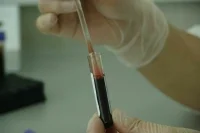 В Южной Корее впервые выявили случай заражения «поедающей мозг» амебой