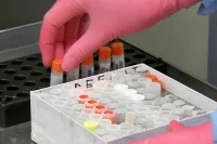 Регулирование клеточных продуктов предложили соотнести с нормами ЕАЭС
