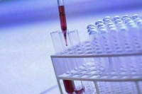 Субсидии на антидопинговые мероприятия будут выделять по-новому