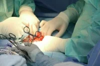 Врачи в Донецке в бронежилетах извлекли из пациента неразорвавшуюся мину