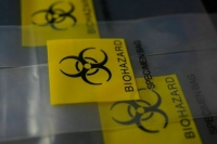 Минобороны: Под контролем США изучаются пути заражения человека бруцеллезом