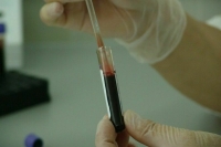 В Московском политехе выявили случай заболевания корью