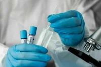 В ВОЗ сообщили о росте заболеваемости коронавирусом в мире на 38% за 28 дней