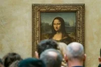 У Моны Лизы диагностировали облысение