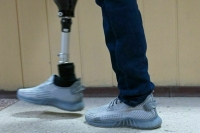 К протезированию дополнительно привлекут пять военных госпиталей