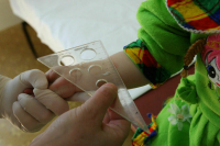 Не мочить Манту: врач развенчал популярные мифы о туберкулезе