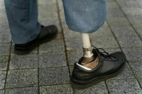 Генпрокуратура предотвратила многомиллионные закупки некачественных протезов