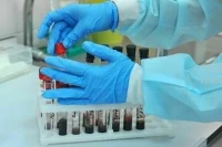 Минздрав обновит порядок обязательной проверки на ВИЧ