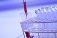 Минздрав добавит новое заболевание в неонатальный скрининг
