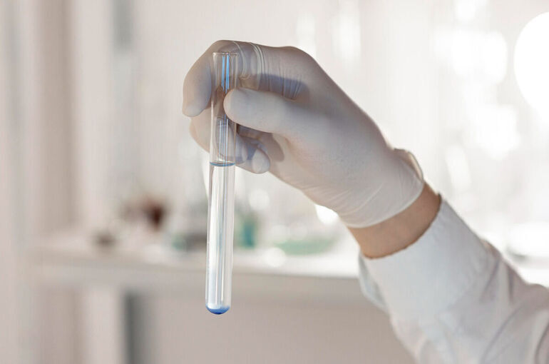 Россиянки смогут сдать анализ на ВПЧ на первом этапе диспансеризации