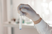 Россиянки смогут сдать анализ на ВПЧ на первом этапе диспансеризации