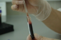 Минздрав разработал новый стандарт медпомощи детям с хроническим гепатитом C