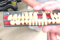 Студенты из Санкт-Петербурга придумали, как удешевить зубные протезы