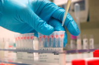 В Минздраве оценили охват тестированием на ВИЧ