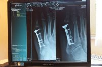 В больницах Солнечногорска появились новые рентген-аппараты