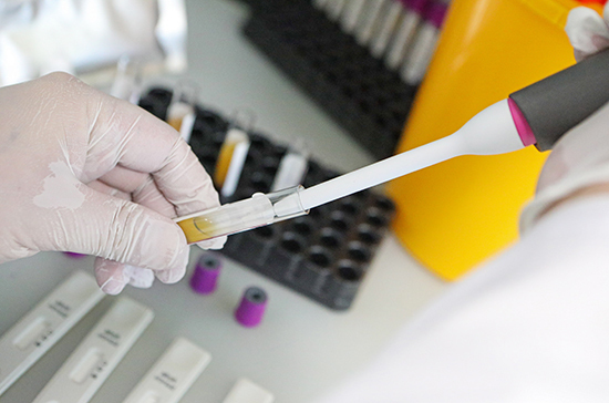 В Роспотребнадзоре рассказали о количестве производимых тест-систем для ПЦР-диагностики коронавируса