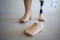 Почему инвалидам не хватало протезов  