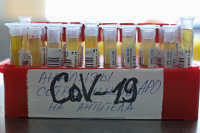 В ВОЗ заявили о выходе на плато по заболеваемости и смертности коронавирусом