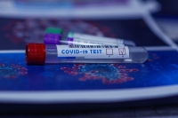 Тест на антитела к коронавирусу предложили включить в ОМС