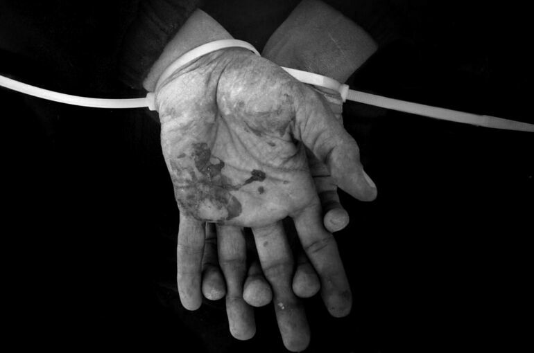 Омбудсмен ДНР: 95% обмененных республикой пленных подвергались пыткам на Украине