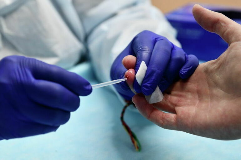 Эксперт рассказал, где можно бесплатно и анонимно сдать тест на ВИЧ-инфекцию