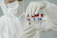 В Монголии выявили три случая подозрения на бубонную чуму