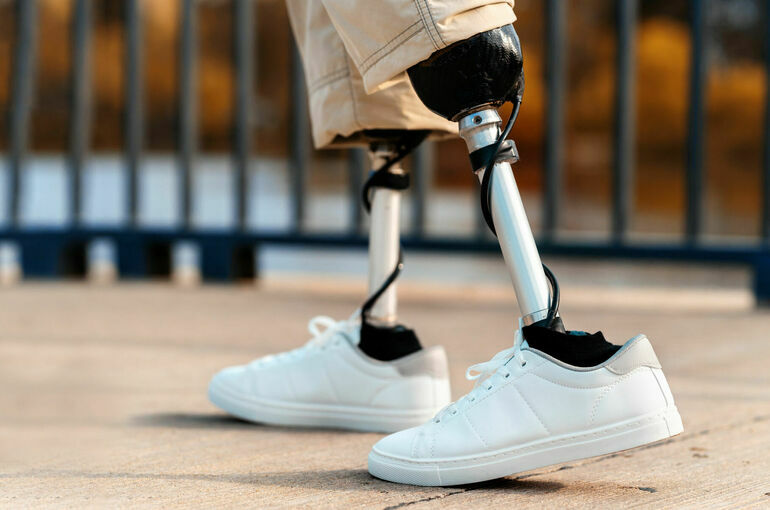 Производство высокотехнологичных протезов запустят еще в 7 регионах