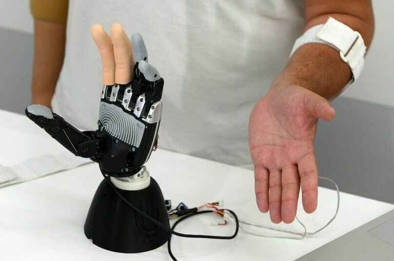 Космические технологии и ограничение импорта: как в России развивается производство бионических протезов