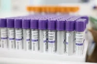 Диспансеризацию вернувшихся домой бойцов СВО проведут по новым правилам